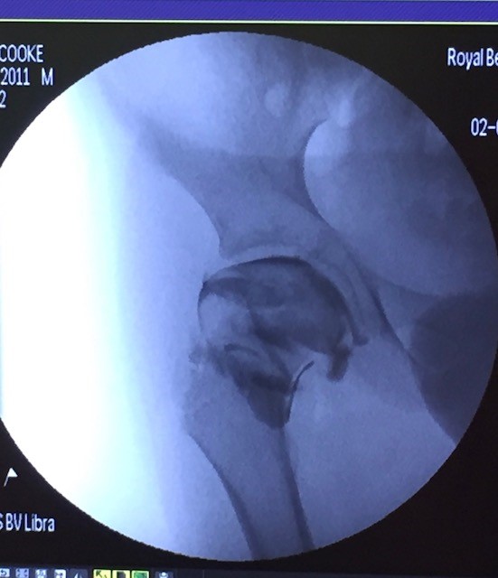 Arthrogram scan image